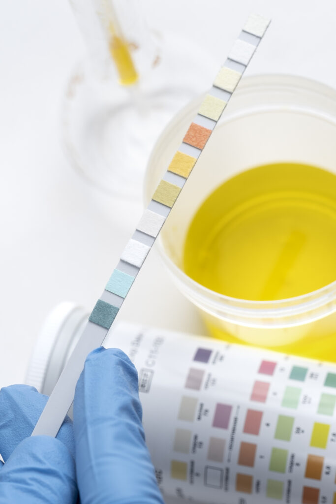 Servicios de Aguas Residuales